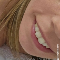 rose_louise_lee Nagie