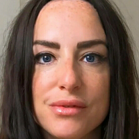 scarred4life3 Nagie