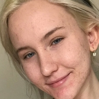 Trippi Miki Nagie